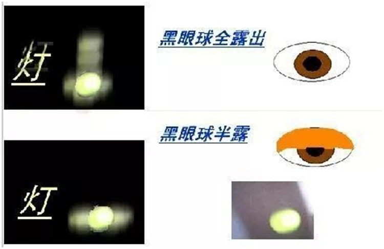 看到路灯散出几道光线就是散光吗